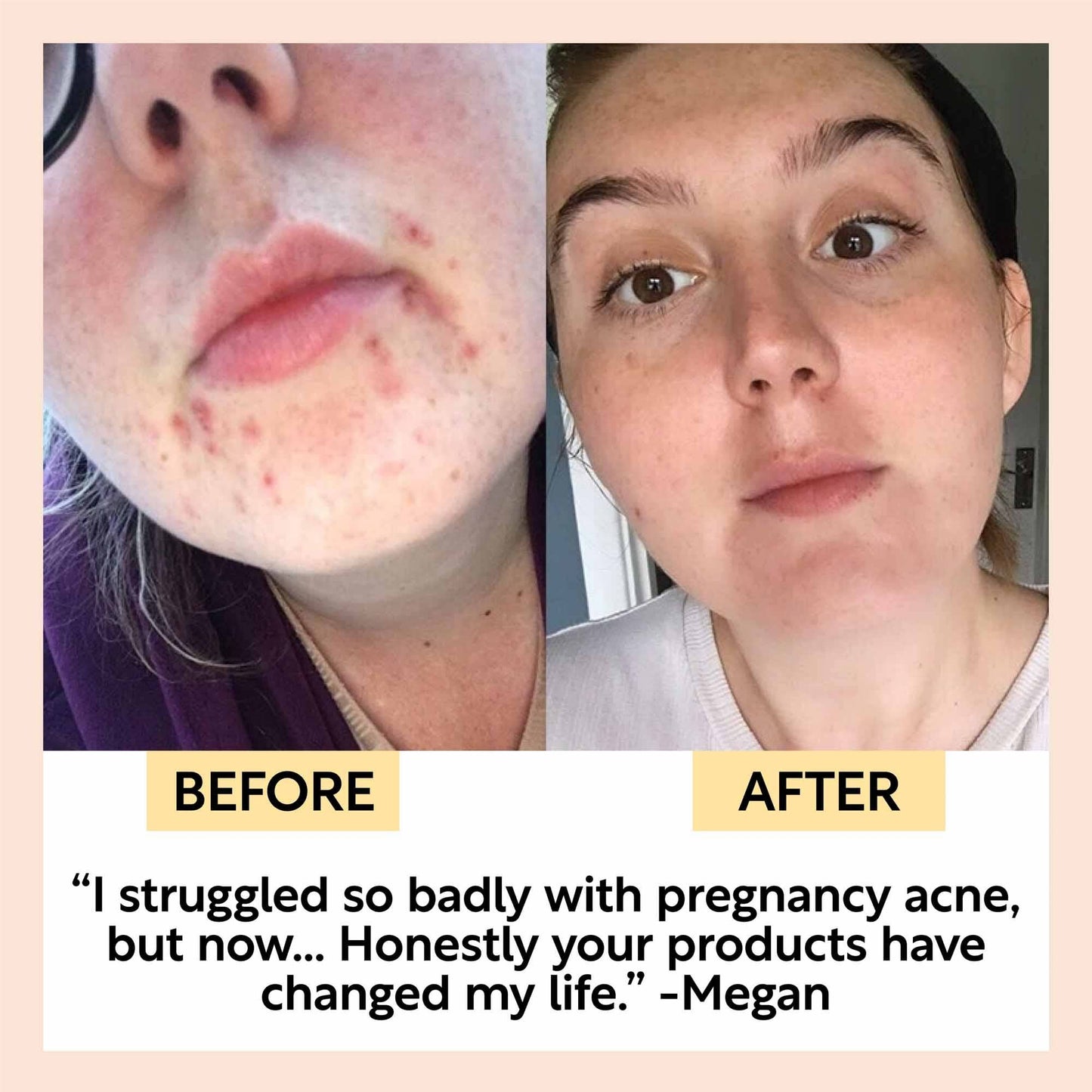 Face Moisturiser with Vitamin E + Aloe Vera
